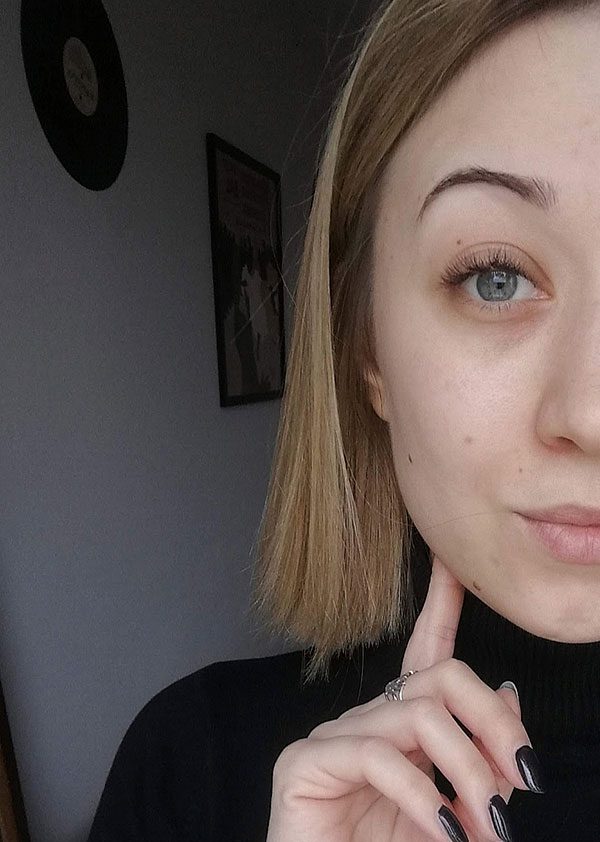 Anna Szatybełko po zabiegu